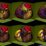 Atrial flutter with a circling excitation