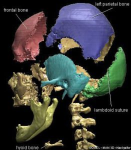 Exploded View of the Skull