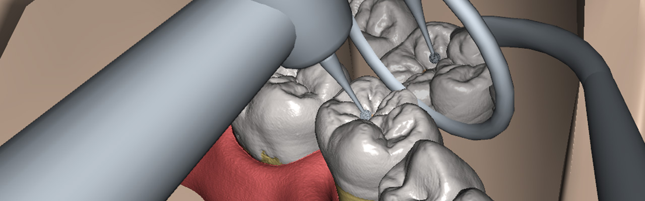 VOXEL-MAN receives EXIST Forschungstransfer grant for dental simulator