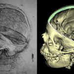The skull sectioned (1489)
