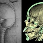 The skull sectioned (1489)