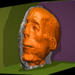 Facial reconstruction of Khonsu-maa-kheru from CT