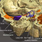 temporal bone