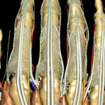 3D anatomical atlas of the arm and hand