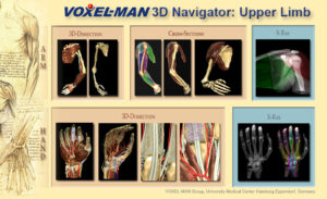 Visuelles Inhaltsverzeichnis des Voxel-Man 3D-Navigator: Obere Extremität