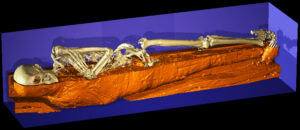 Virtual mummy of Mr. X with a median section