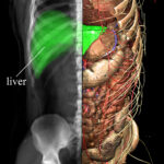 Liver in the anatomical model and a simulated X-ray image