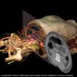 Cross-sectional anatomy of the torso with a corresponding CT image