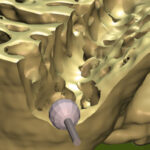 Découpe de haute précision de formes complexes