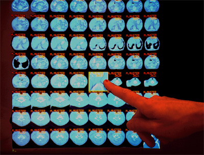 Touch screen user interface of the image data base