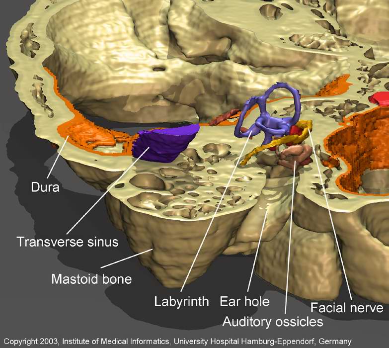 Organs of the middle ear 2003