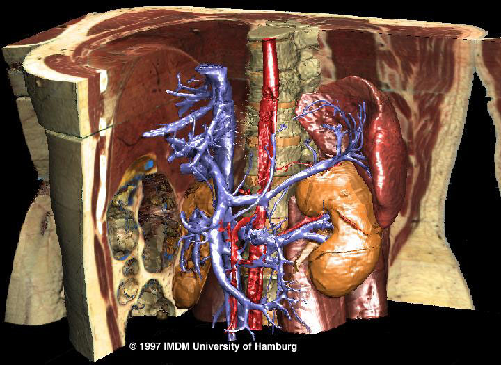 VOXEL-MAN/Inner Organs Atlas: Abdomen cut open