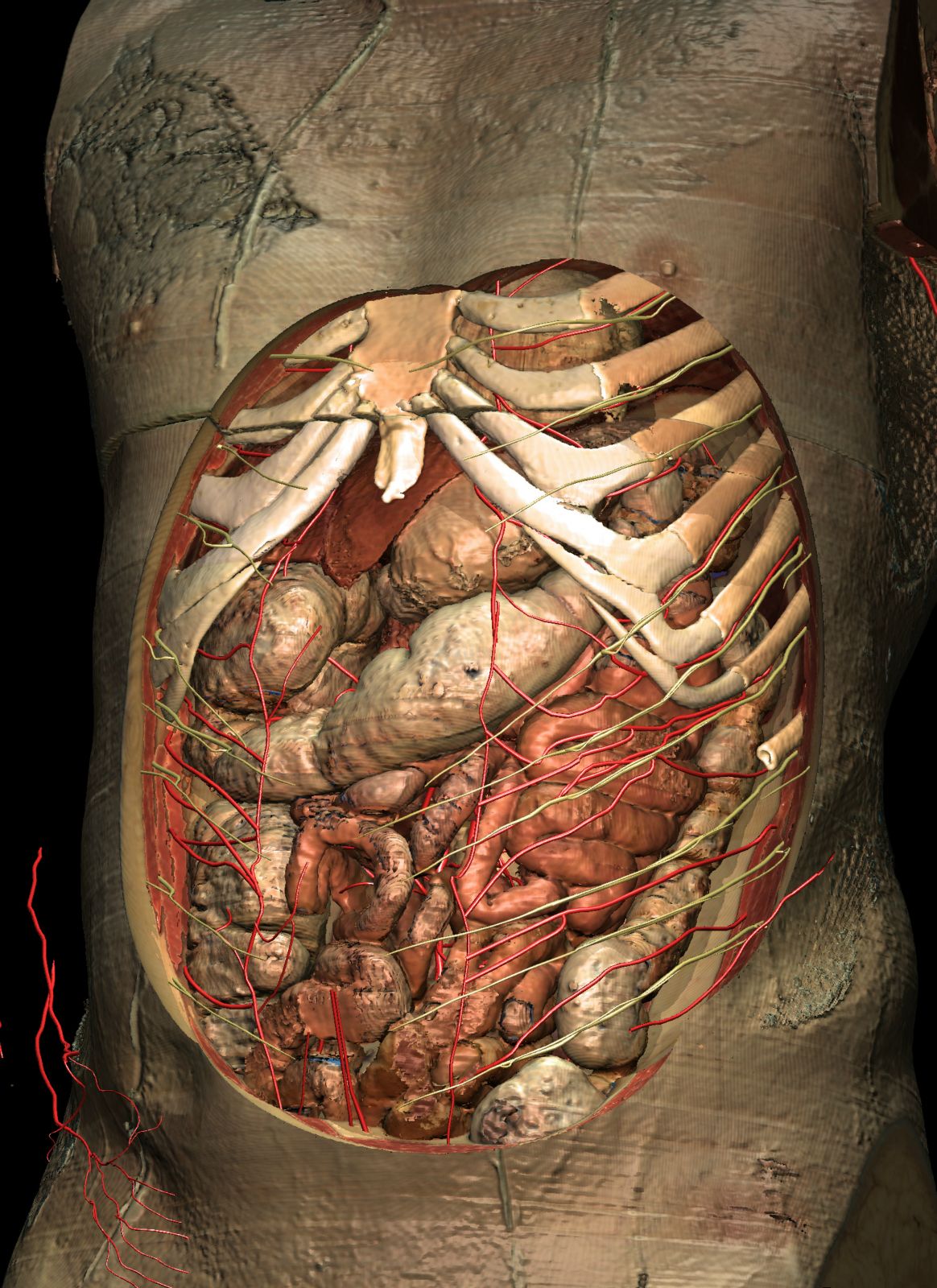 VOXEL-MAN/Inner Organs Atlas: A round window to the abdomen