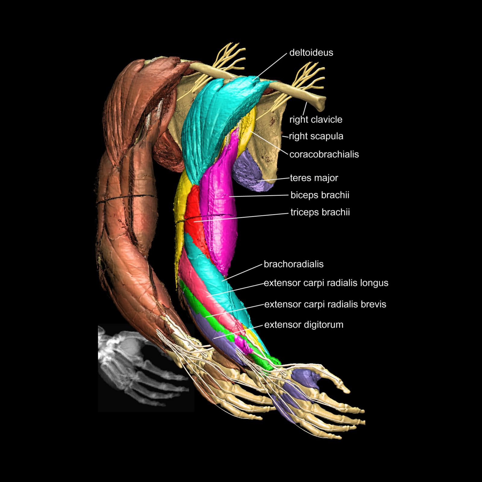 VOXEL-MAN/Upper Limb Atlas: Details of arm musculature