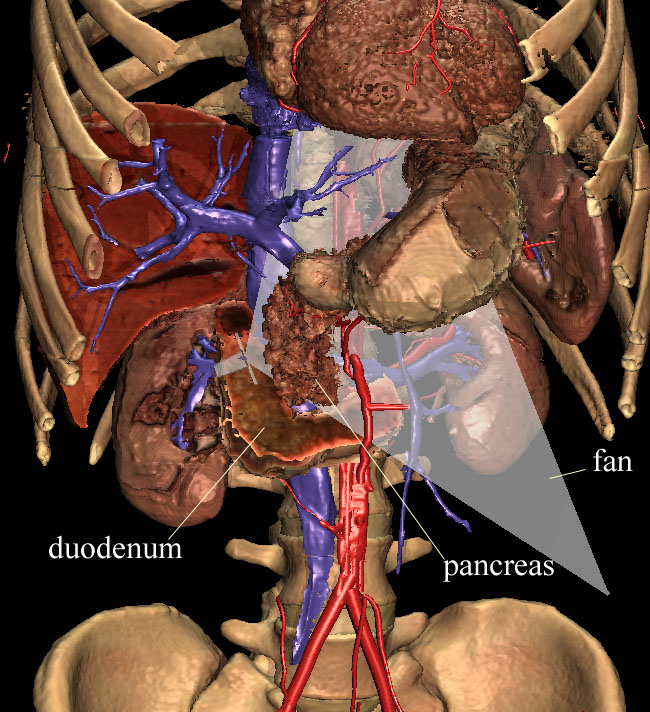In the VOXEL-MAN/Inner Organs Atlas an interior viewpoint like in endoscopic ultrasound (EUS) can be placed