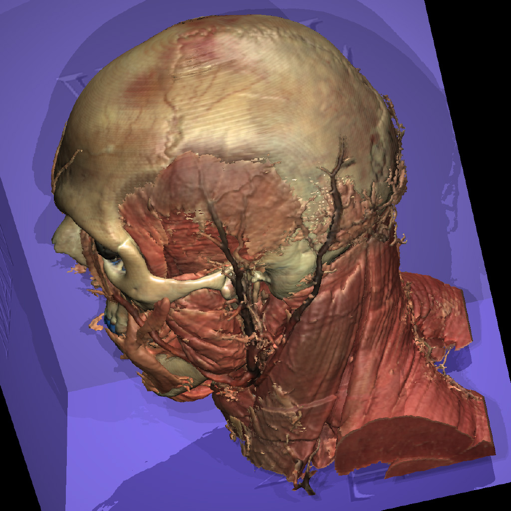 Musculature of the Visible Human's head rendered with the VOXEL-MAN system
