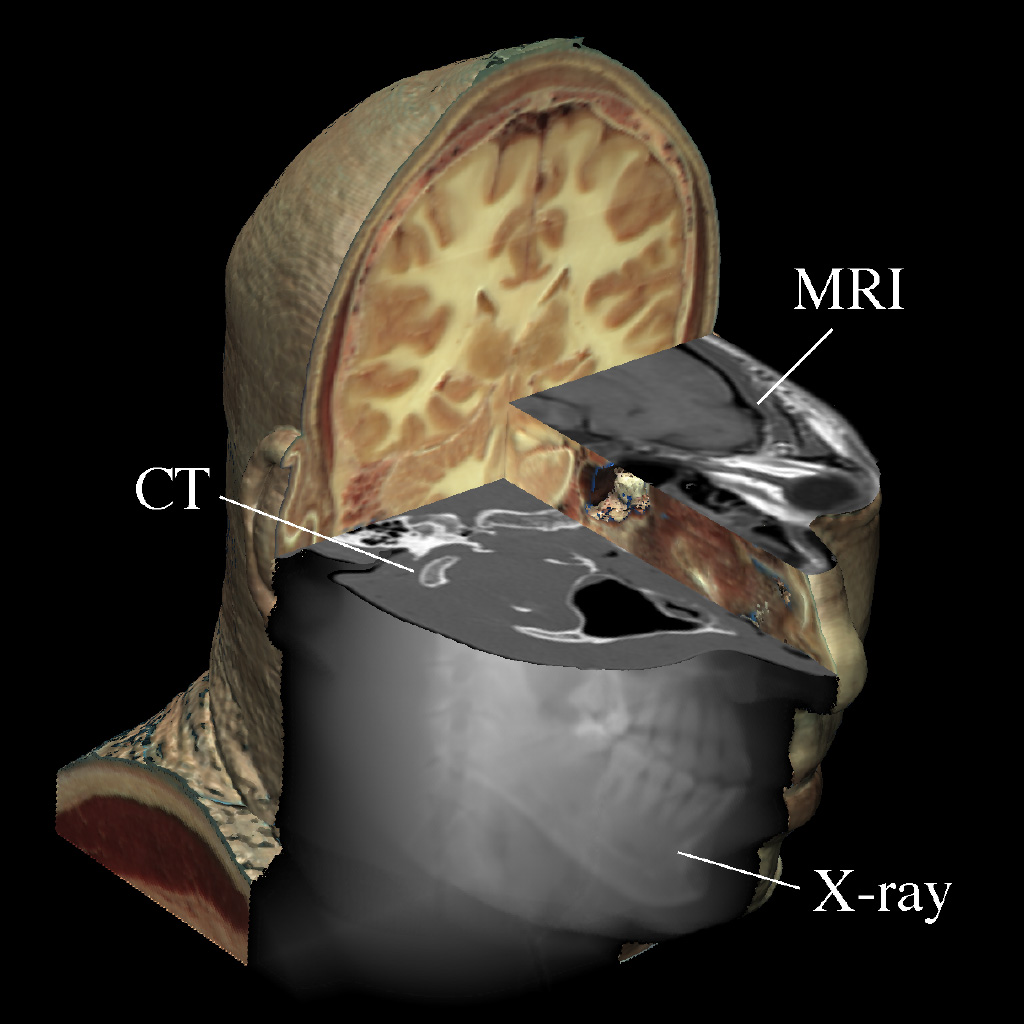 Demonstration of VOXEL-MAN's capability to combine anatomical and radiological appearance