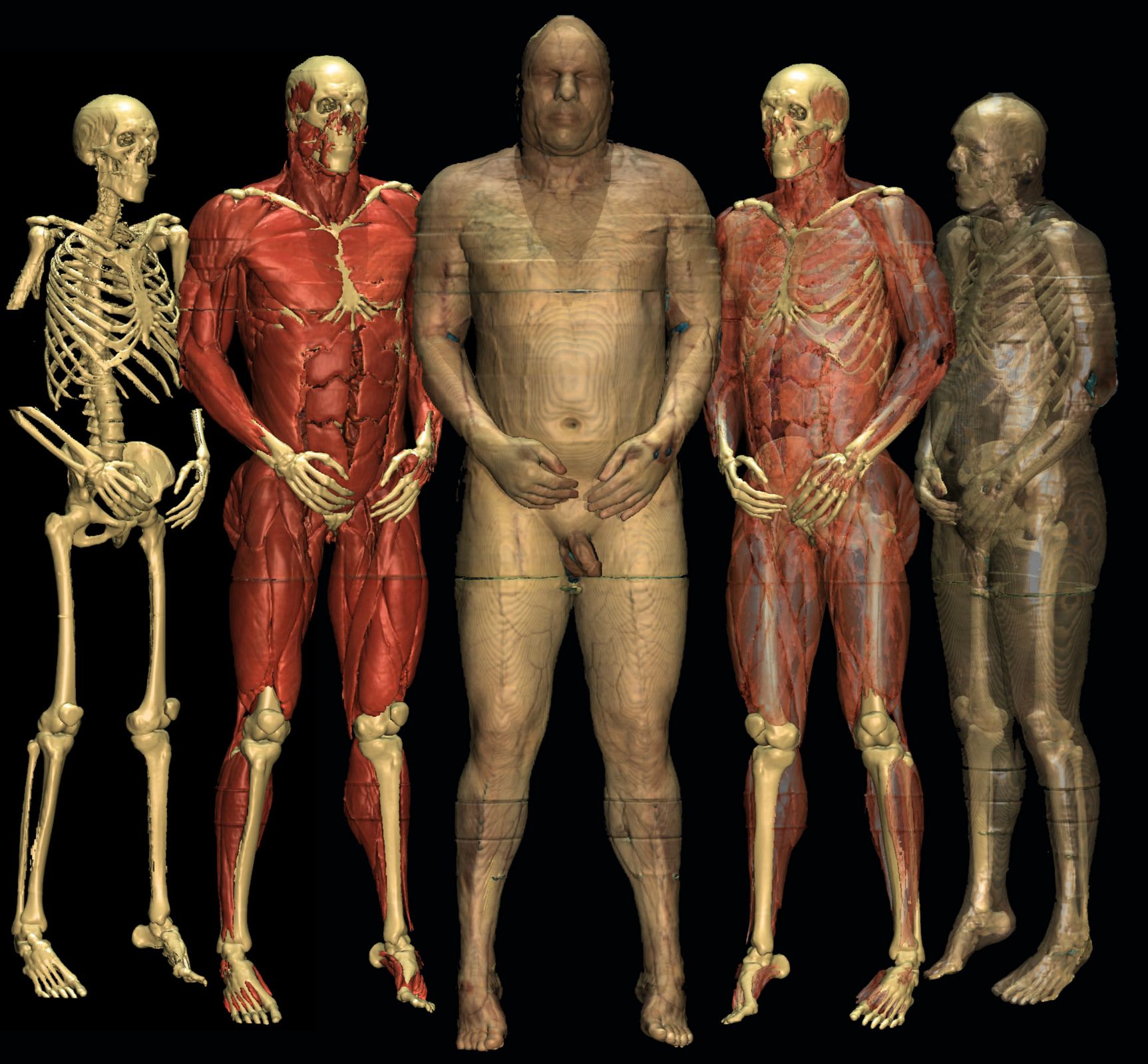 Different renderings of the Visible Human created with the VOXEL-MAN system