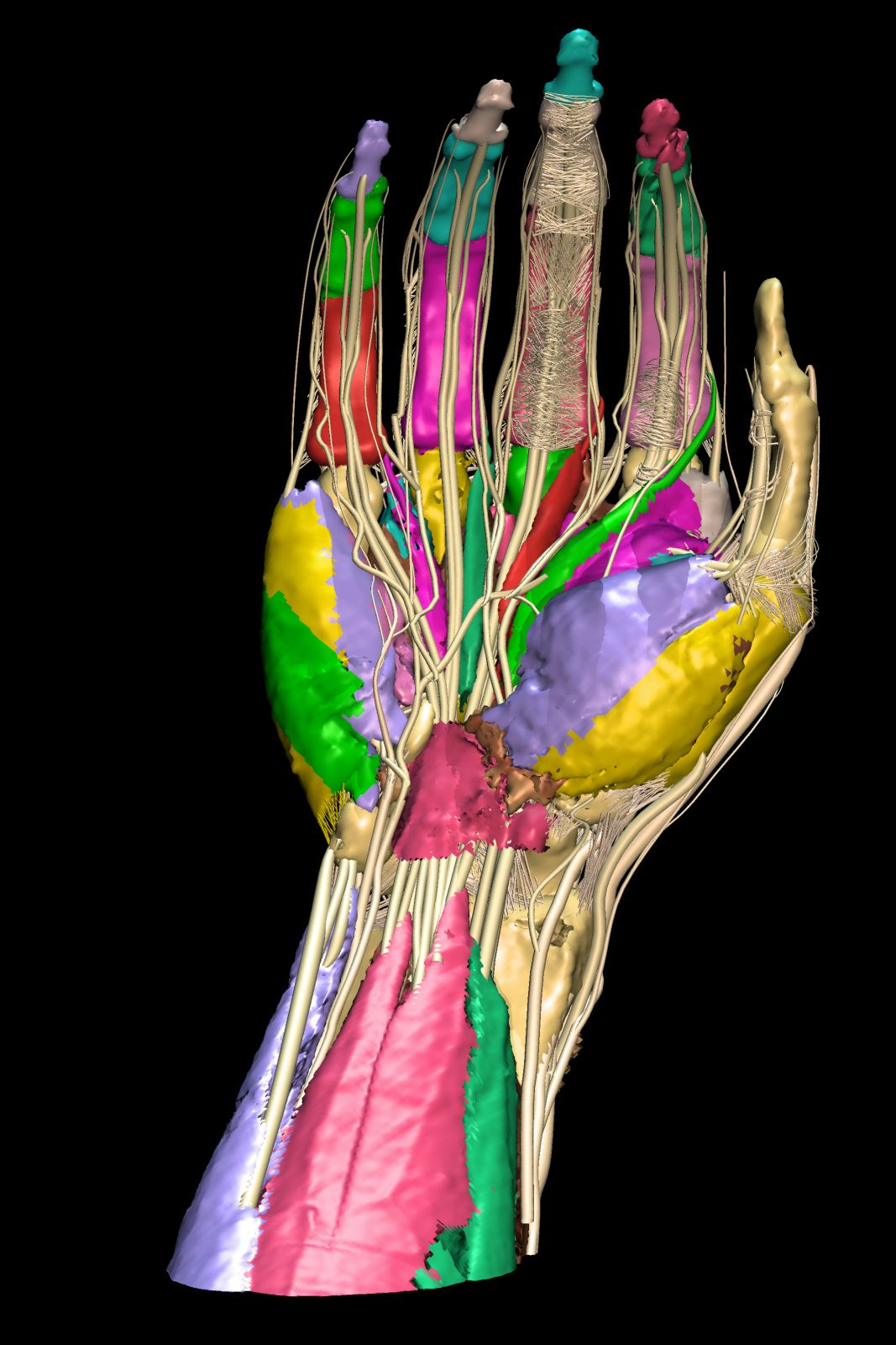 VOXEL-MAN/Upper Limb: A user has color-marked selected objects by mouse click