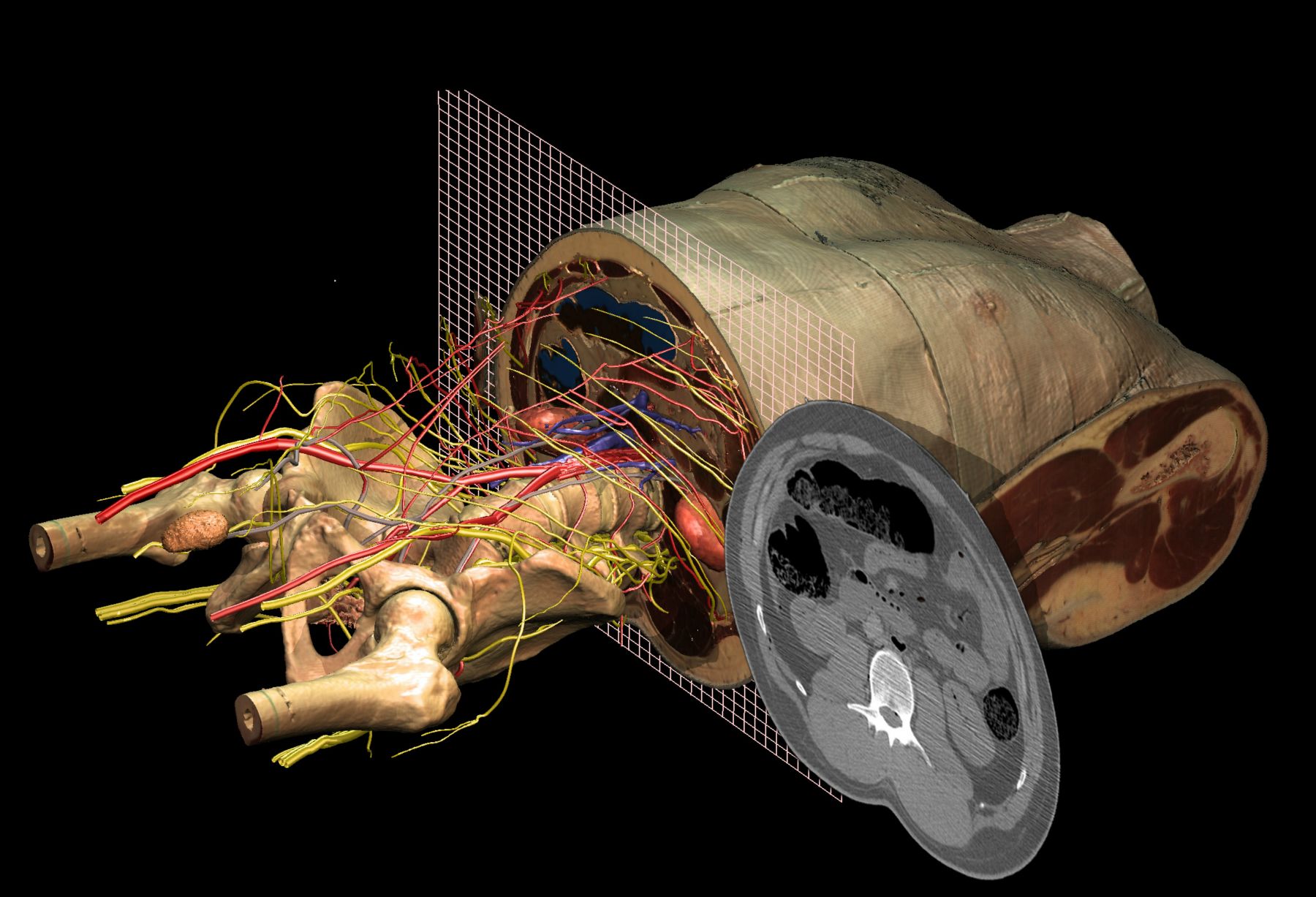 The VOXEL-MAN/Inner Organs Atlas allows correlation of 3D and cross-sectional anatomy