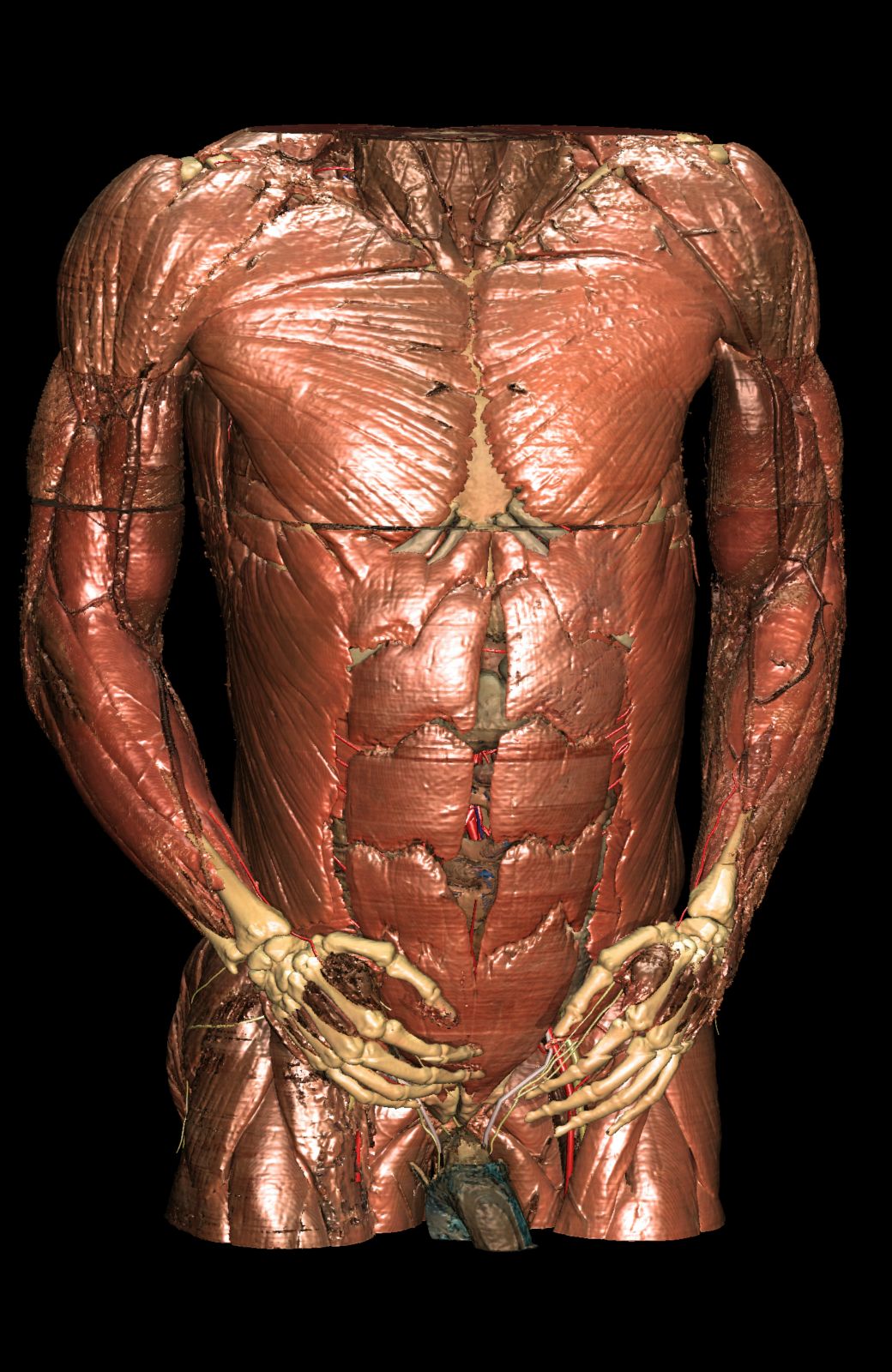 The muscles of the Visible Human's torso