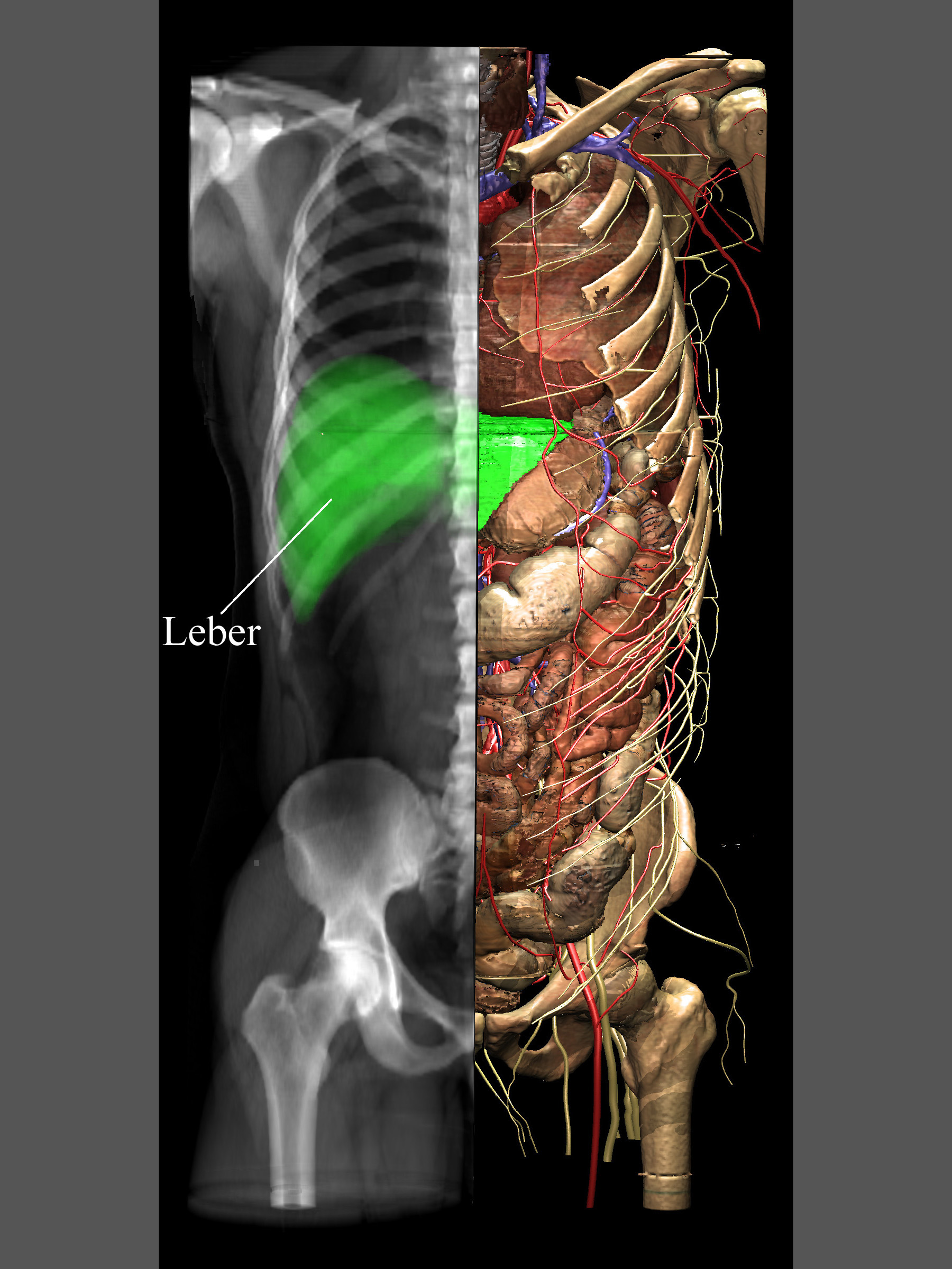 In the VOXEL-MAN/Inner Organs Atlas anatomical and X-ray appearance can be combined