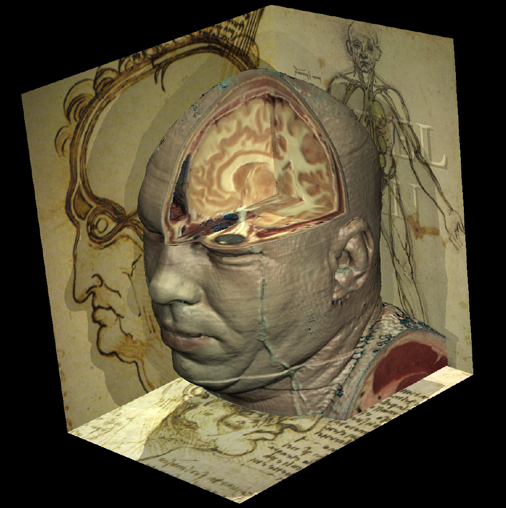 The Visible Human's head surrounded by drawings of Leonardo da Vinci rendered with the VOXEL-MAN system