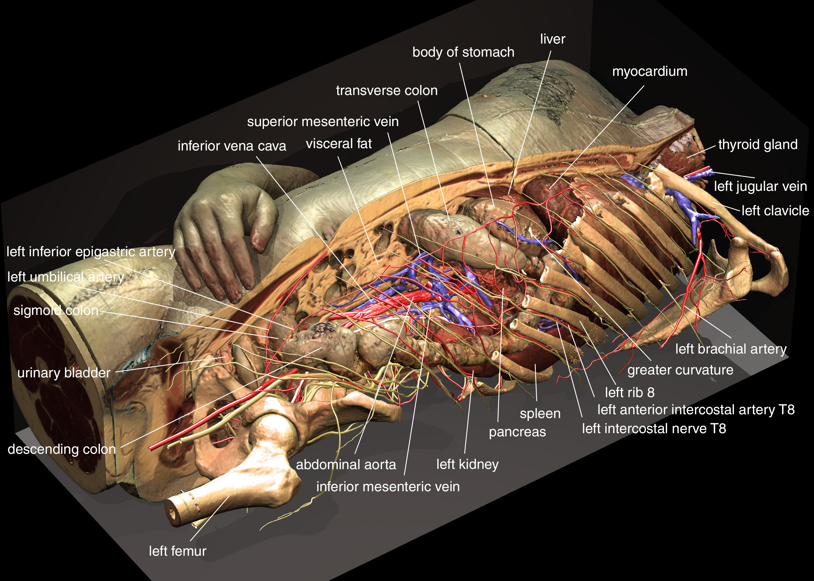 VOXEL-MAN/Inner Organs Atlas: A user has chosen a view with a sagittal cut and has asked for annotations